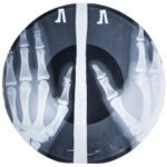 radiografia Bone Music 2