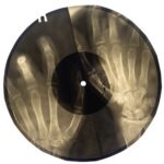radiografia Bone Music 4